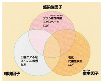 歯周病の主な原因について